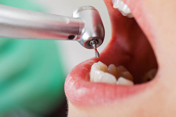Best Emergency Treatment for Dental Infections or Abscesses in Stanton, NE